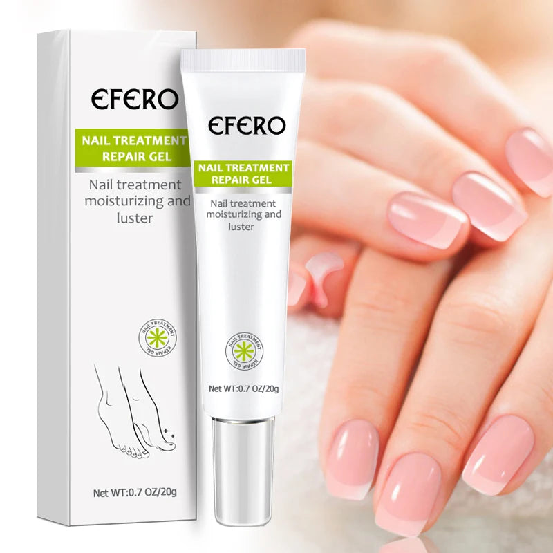 Tratamento fúngico das unhas soro unha do pé gel de remoção de fungos anti infecção onicomicose reparação das unhas essência creme cuidados com os pés