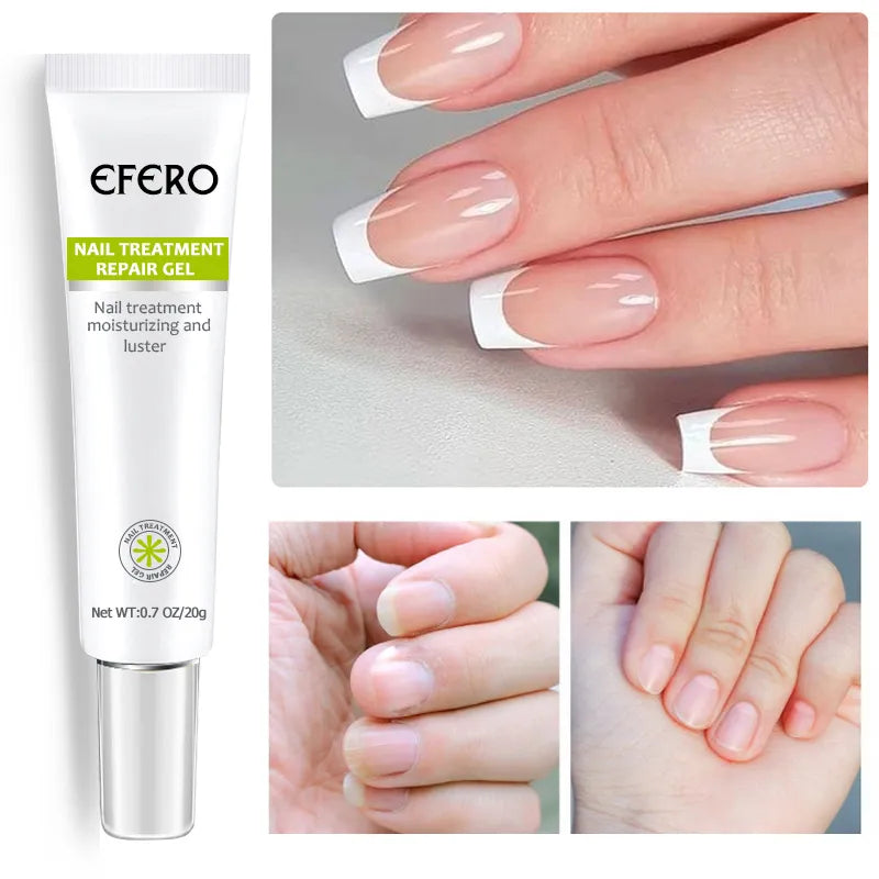 Tratamento fúngico das unhas soro unha do pé gel de remoção de fungos anti infecção onicomicose reparação das unhas essência creme cuidados com os pés