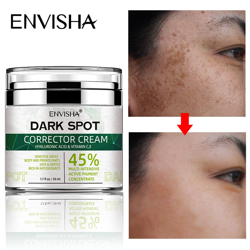 ENVISHA-Clareamento Creme De Sardas, Anti-Envelhecimento, Clareamento, Encolher Poros, Hidratação, Melasma, Manchas Escuras, Melanina, Face Care, Clareamento, Remover, Melasma