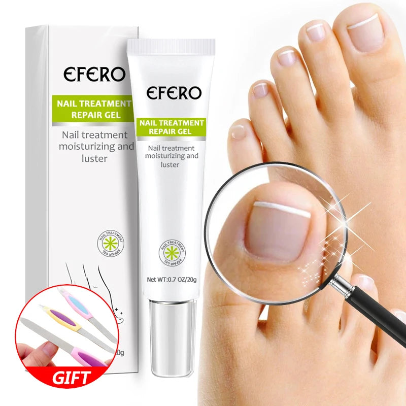 Tratamento fúngico das unhas soro unha do pé gel de remoção de fungos anti infecção onicomicose reparação das unhas essência creme cuidados com os pés