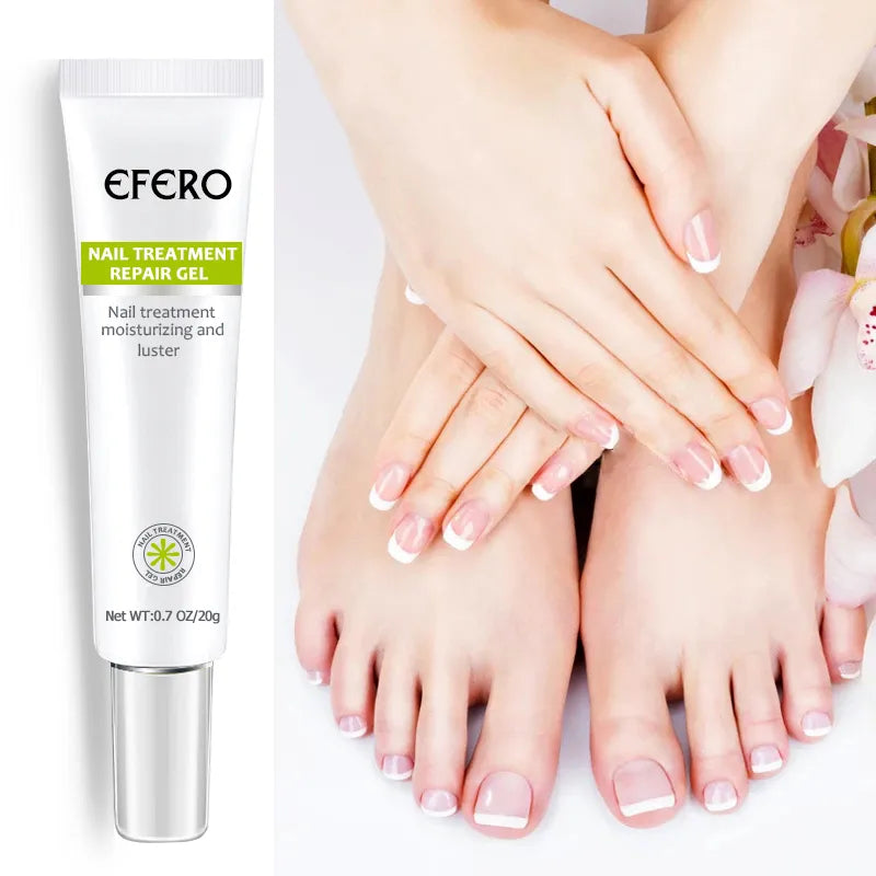 Tratamento fúngico das unhas soro unha do pé gel de remoção de fungos anti infecção onicomicose reparação das unhas essência creme cuidados com os pés