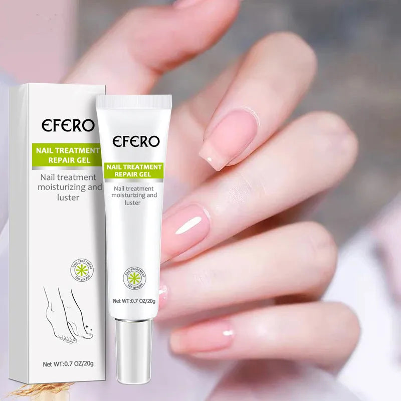 Tratamento fúngico das unhas soro unha do pé gel de remoção de fungos anti infecção onicomicose reparação das unhas essência creme cuidados com os pés